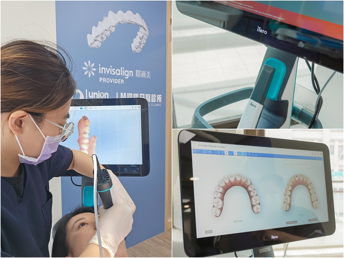 善化牙醫｜LM迎曦牙醫診所，黃柏青醫師隱適美諮詢(南科牙醫診所)