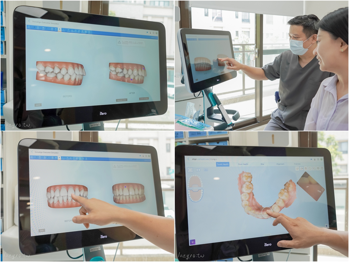 善化牙醫｜LM迎曦牙醫診所，黃柏青醫師隱適美諮詢(南科牙醫診所)